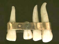 Foto dente artificial