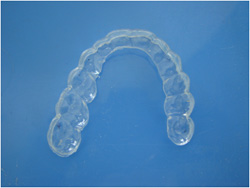 Aparelho Oclusal