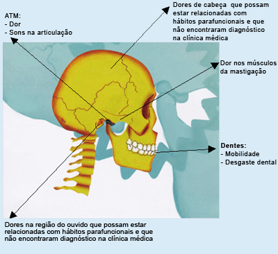 Desordens Temporomandibulares